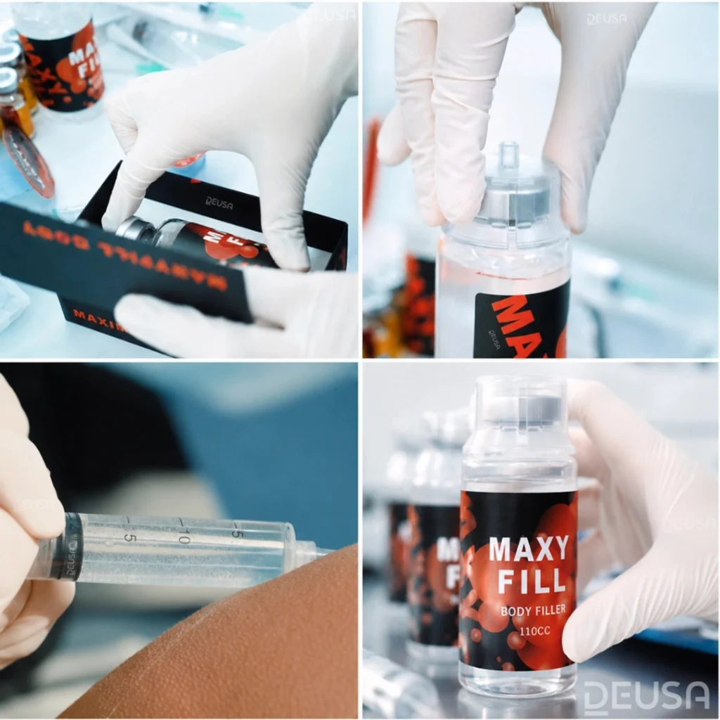 Maxy Fill